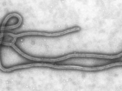 Côte d’Ivoire : une nouvelle maladie à fièvre hémorragie de Crimée-Congo fait son apparition en Afrique de l’Ouest