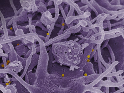 Fiche Technique Santé-Sécurité : Agents Pathogènes – Virus de la fièvre hémorragique de Crimée-Congo
