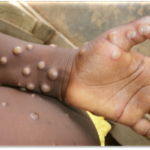 WOAH : “The veterinary workforce plays a key role in the global One Health agenda”woah“The veterinary workforce plays a key role in the global One Health agenda”