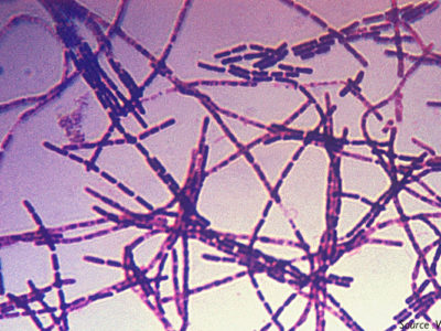 Confirmation of Anthrax Outbreak in Nigeria
