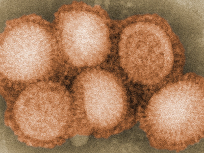 Disease Outbreak News : Avian Influenza A (H5N2) – Mexico
